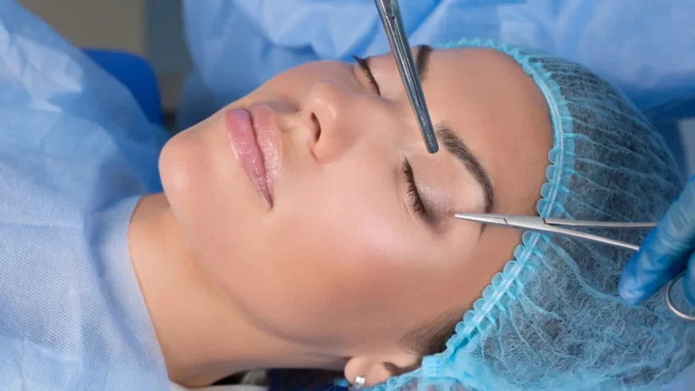 eyelid surgery