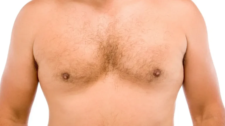 male chest reduction