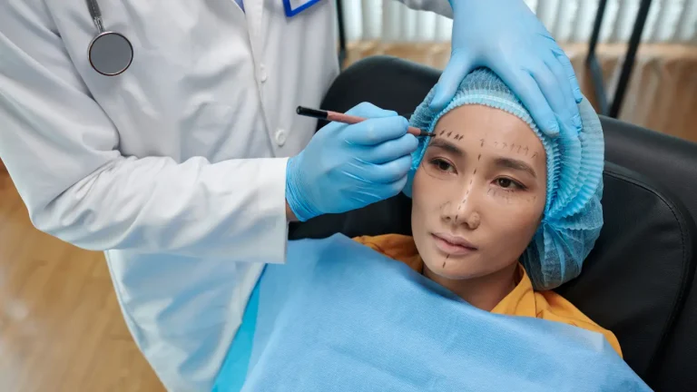 facelift surgery