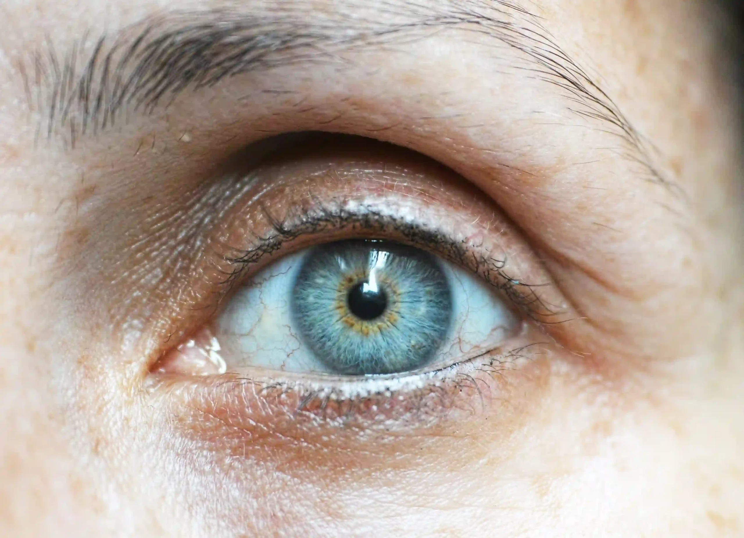 Upper vs Lower Blepharoplasty What's the Difference?